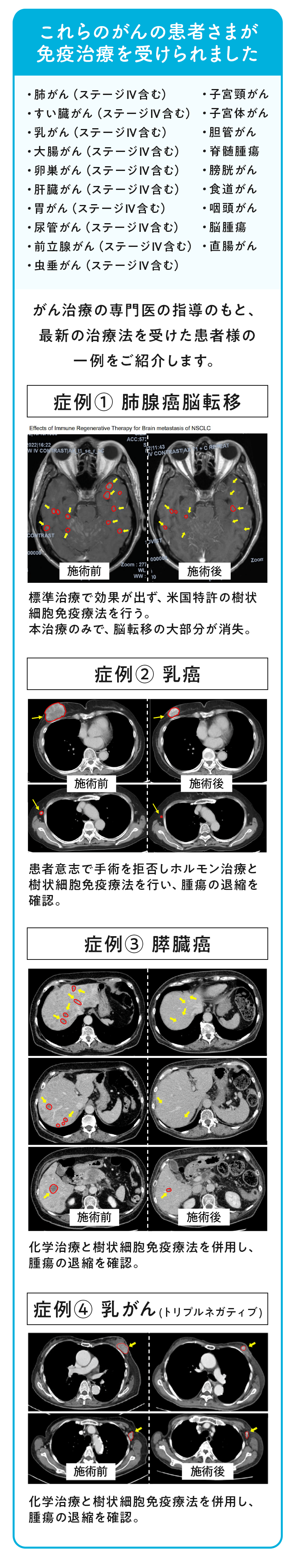 治療実績